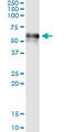 Coagulation Factor IX antibody, LS-C197179, Lifespan Biosciences, Immunoprecipitation image 