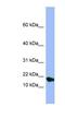 Submaxillary gland androgen-regulated protein 3A antibody, NBP1-58000, Novus Biologicals, Western Blot image 