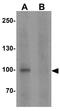 Storkhead Box 1 antibody, GTX32076, GeneTex, Western Blot image 