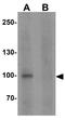 C10orf24 antibody, GTX32076, GeneTex, Western Blot image 