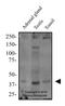 Estrogen Receptor 2 antibody, NBP2-81132, Novus Biologicals, Western Blot image 