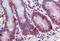 ADP Ribosylation Factor Like GTPase 2 antibody, MBS247411, MyBioSource, Immunohistochemistry paraffin image 