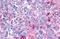 Frizzled Class Receptor 8 antibody, NLS4766, Novus Biologicals, Immunohistochemistry paraffin image 