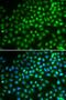 SWI/SNF-related matrix-associated actin-dependent regulator of chromatin subfamily A member 5 antibody, LS-C331814, Lifespan Biosciences, Immunofluorescence image 