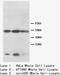 Keratin 8 antibody, LS-C172058, Lifespan Biosciences, Western Blot image 