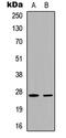 Cyclin Dependent Kinase Inhibitor 1B antibody, LS-C354630, Lifespan Biosciences, Western Blot image 