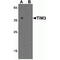 Hepatitis A Virus Cellular Receptor 2 antibody, TA355031, Origene, Western Blot image 