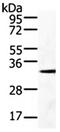 GDNF Family Receptor Alpha 4 antibody, orb107586, Biorbyt, Western Blot image 