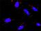 Ribosomal Protein S6 Kinase A5 antibody, H00009252-M01, Novus Biologicals, Proximity Ligation Assay image 