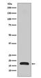 Actin Related Protein 2/3 Complex Subunit 5 antibody, M02096, Boster Biological Technology, Western Blot image 