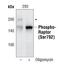 Regulatory Associated Protein Of MTOR Complex 1 antibody, PA5-17116, Invitrogen Antibodies, Western Blot image 