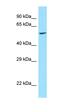 Protein Kinase C Substrate 80K-H antibody, orb331255, Biorbyt, Western Blot image 