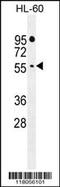 F-Box And WD Repeat Domain Containing 11 antibody, MBS9212162, MyBioSource, Western Blot image 