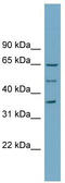 WD Repeat Domain 33 antibody, TA336161, Origene, Western Blot image 