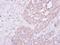 Phenylalanine--tRNA ligase alpha chain antibody, NBP1-33308, Novus Biologicals, Immunohistochemistry paraffin image 