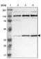 Ribosomal RNA Processing 7 Homolog A antibody, PA5-51604, Invitrogen Antibodies, Western Blot image 