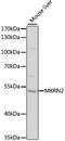 Makorin Ring Finger Protein 2 antibody, LS-C747380, Lifespan Biosciences, Western Blot image 