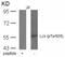 LCK Proto-Oncogene, Src Family Tyrosine Kinase antibody, 79-509, ProSci, Western Blot image 