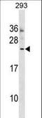 Motile sperm domain-containing protein 3 antibody, LS-C158164, Lifespan Biosciences, Western Blot image 