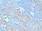 c-Kit antibody, NBP2-33192, Novus Biologicals, Immunohistochemistry paraffin image 
