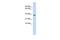 DDB1 And CUL4 Associated Factor 4 Like 1 antibody, GTX45412, GeneTex, Western Blot image 