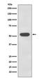 Keratin 4 antibody, M07410-1, Boster Biological Technology, Western Blot image 