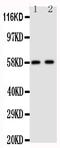 Arom antibody, PA1489, Boster Biological Technology, Western Blot image 