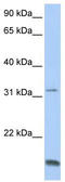 Titin-Cap antibody, TA346577, Origene, Western Blot image 