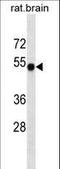 Calcium/Calmodulin Dependent Protein Kinase II Alpha antibody, LS-C162467, Lifespan Biosciences, Western Blot image 