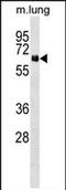 Neuroepithelial Cell Transforming 1 antibody, PA5-71998, Invitrogen Antibodies, Western Blot image 