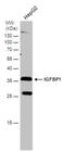 Insulin Like Growth Factor Binding Protein 1 antibody, PA5-78020, Invitrogen Antibodies, Western Blot image 