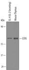 C-C Motif Chemokine Receptor 5 (Gene/Pseudogene) antibody, AF6138, R&D Systems, Western Blot image 