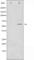 SMAD Family Member 3 antibody, abx011533, Abbexa, Western Blot image 