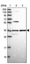Sorting Nexin 11 antibody, PA5-60827, Invitrogen Antibodies, Western Blot image 