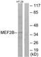 Myocyte Enhancer Factor 2B antibody, TA316487, Origene, Western Blot image 