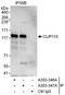 CAP-Gly domain-containing linker protein 2 antibody, A303-346A, Bethyl Labs, Immunoprecipitation image 