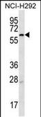 Membrane Bound Transcription Factor Peptidase, Site 2 antibody, PA5-48486, Invitrogen Antibodies, Western Blot image 