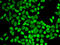 Interleukin 7 Receptor antibody, 14-353, ProSci, Immunofluorescence image 