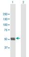 Cathepsin C antibody, H00001075-B01P, Novus Biologicals, Western Blot image 