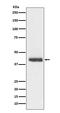 Doublecortin antibody, M01053, Boster Biological Technology, Western Blot image 