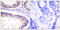 Cbl Proto-Oncogene antibody, LS-C198743, Lifespan Biosciences, Immunohistochemistry paraffin image 