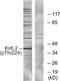 Potassium Voltage-Gated Channel Subfamily J Member 11 antibody, LS-C199170, Lifespan Biosciences, Western Blot image 