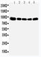 Oxysterol-binding protein 1 antibody, LS-C313083, Lifespan Biosciences, Western Blot image 