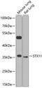 Syntaxin-11 antibody, 23-443, ProSci, Western Blot image 