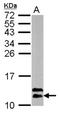 Ring-Box 1 antibody, NBP2-20113, Novus Biologicals, Western Blot image 