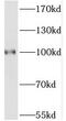 Translocation Associated Membrane Protein 1 antibody, FNab08926, FineTest, Western Blot image 