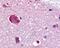 G Protein-Coupled Receptor 61 antibody, 48-302, ProSci, Immunohistochemistry paraffin image 