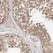 Thyroid Hormone Receptor Interactor 13 antibody, PA5-52193, Invitrogen Antibodies, Immunohistochemistry frozen image 