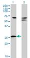 Zinc Finger Protein 266 antibody, H00010781-M02, Novus Biologicals, Western Blot image 