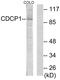 CUB Domain Containing Protein 1 antibody, LS-C119266, Lifespan Biosciences, Western Blot image 